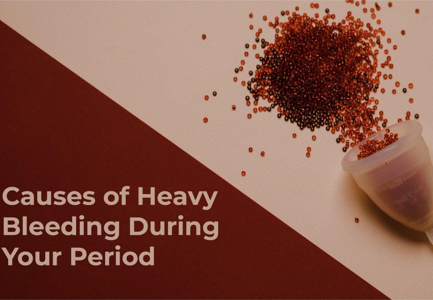 Heavy Bleeding During Your Period