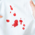 How to Remove Period Stains from Clothes Naturally